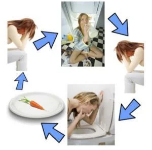 image syndrome boulimie